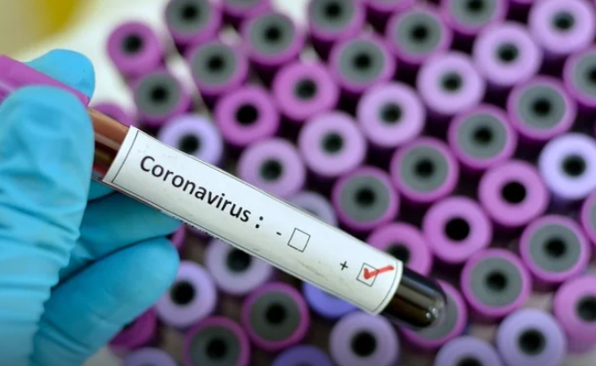 Three Persons Test Positive for Coronavirus in Abuja 1