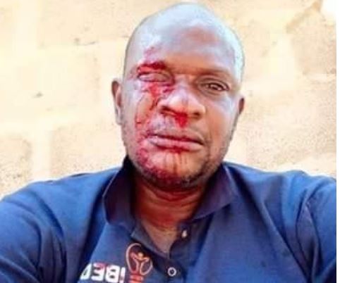 PHCN official attacked while distributing bills in Ogun 1 PHCN official attacked while distributing bills in Ogun 1