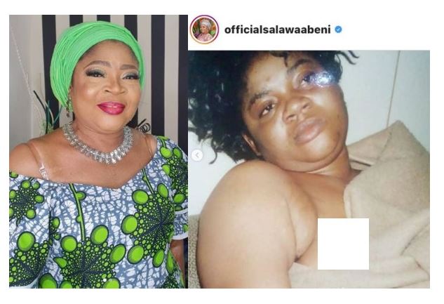 Veteran Singer Salawa Abeni raises alarm after being blackmailed with old 'Nip slip photos'. She then leaks it herself (Photos) 9 Veteran Singer Salawa Abeni raises alarm after being blackmailed with old 'Nip slip photos'. She then leaks it herself (Photos) 9