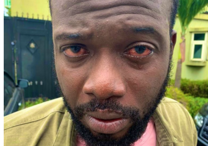 Nigerian Doctor accuses Lebanese Businessman of brutality 3 Nigerian Doctor accuses Lebanese Businessman of brutality 3
