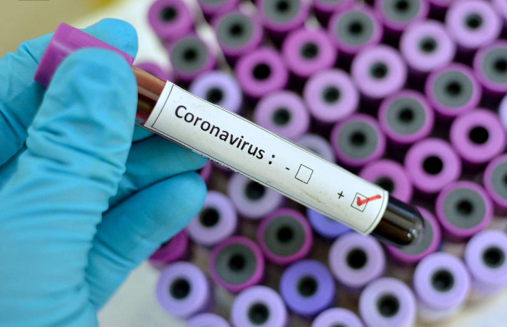 Coronavirus: Madagascar sends cure to Nigeria 1 Coronavirus: Madagascar sends cure to Nigeria 1