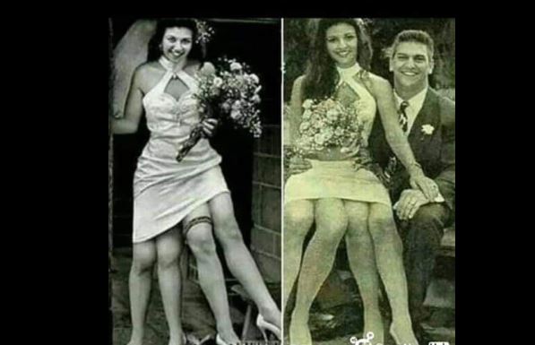 You have issues? Meet The Lady born with 4 legs 33 You have issues? Meet The Lady born with 4 legs 33