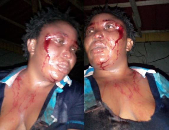 Outrage as man batters his wife then brags about it on Facebook by sharing photos of her bleeding face 1 Outrage as man batters his wife then brags about it on Facebook by sharing photos of her bleeding face 1