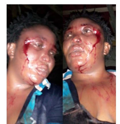Man who battered his wife and bragged about it on Facebook has been arraigned in court, granted N500,000 bail 1 Man who battered his wife and bragged about it on Facebook has been arraigned in court, granted N500,000 bail 1