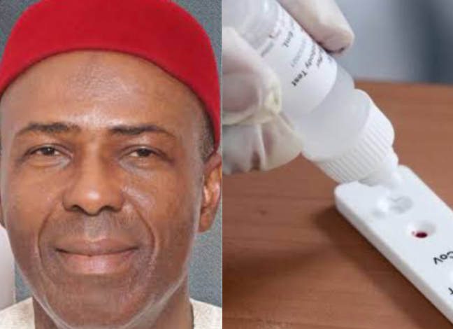 Covid-19 test kit has been developed and will be made available commercially- FG 1 Covid-19 test kit has been developed and will be made available commercially- FG 1