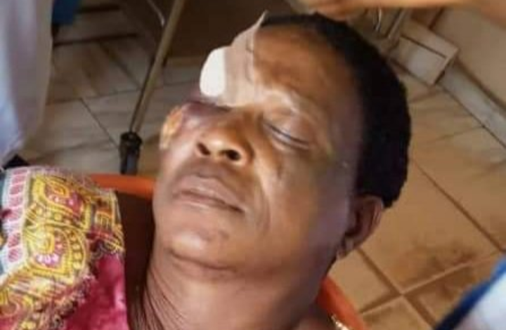 Aggrieved youth beat politician's wife in Edo 1